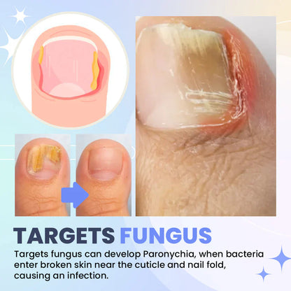 Nail Fungus LED Light Therapy Device