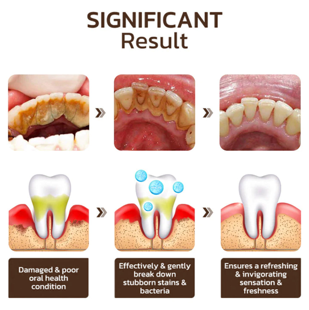 Niacinamide Whitening Toothpaste