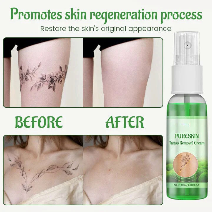 PureSkin Tattoo Removal Cream