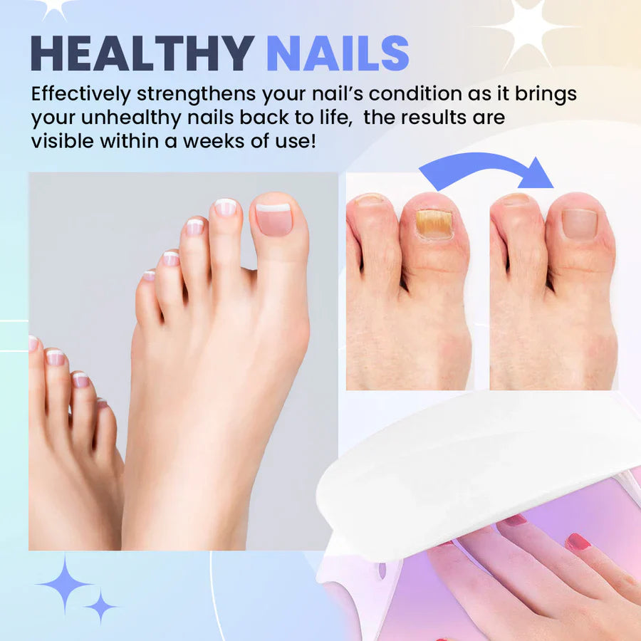 Nail Fungus LED Light Therapy Device