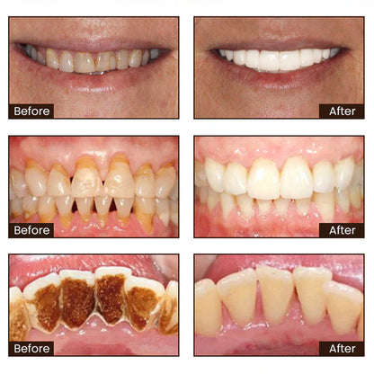 Niacinamide Whitening Toothpaste