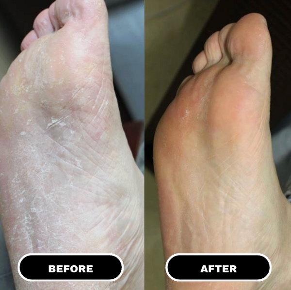 LuxeSole™ Foot Care Stick
