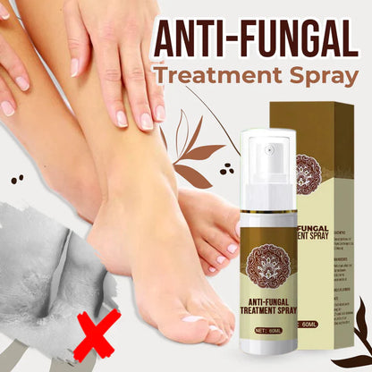 Anti-Fungal Foot Spray