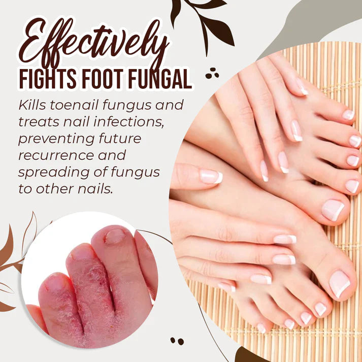 Anti-Fungal Foot Spray